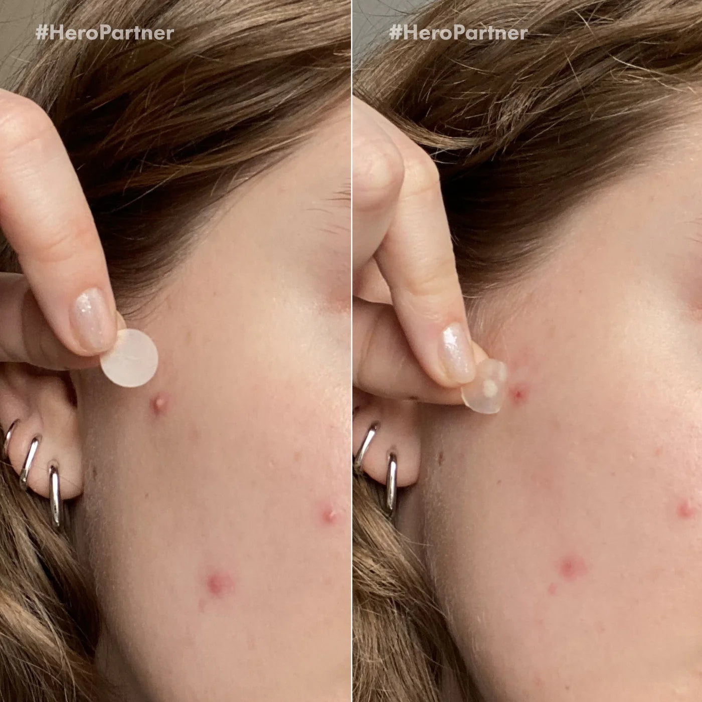 Mighty Patch™ Duo patches